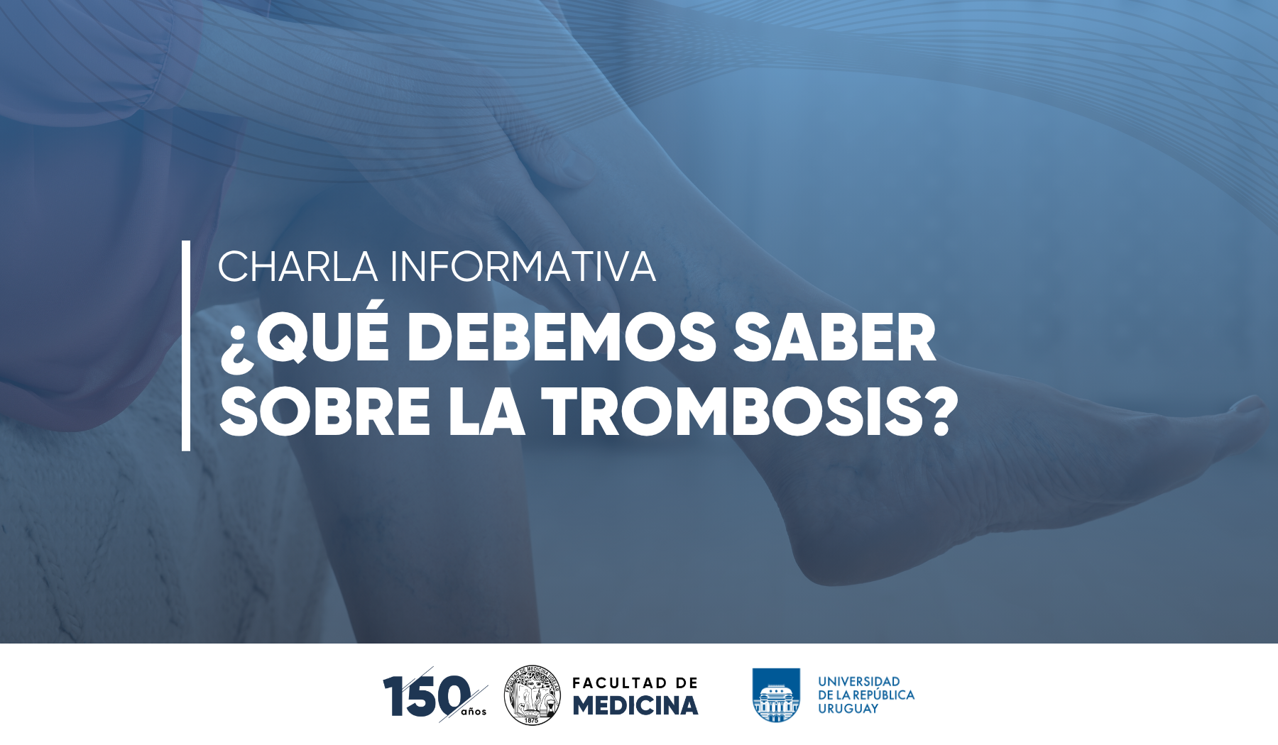 Charla informativa: ¿Qué debemos saber sobre la trombosis?